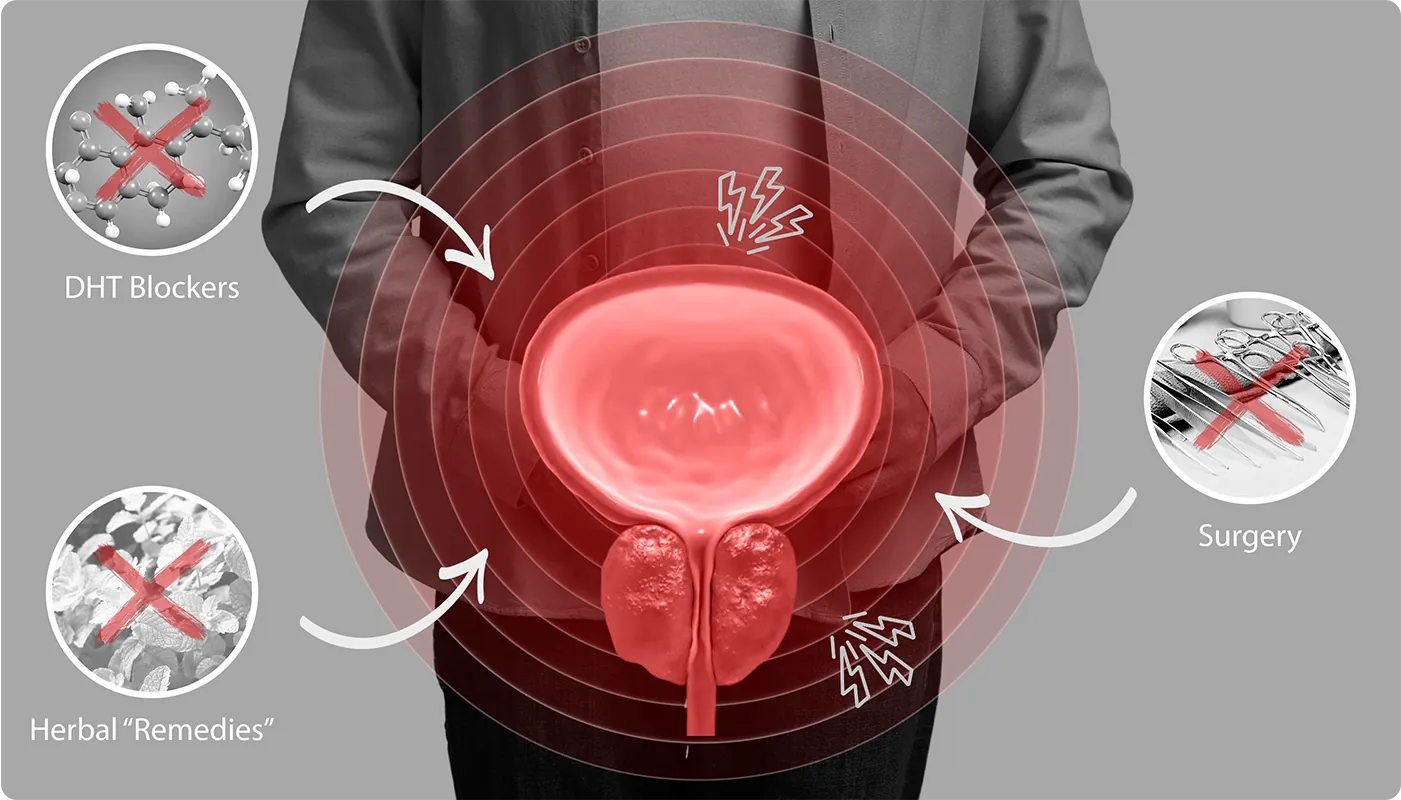 prostate relief