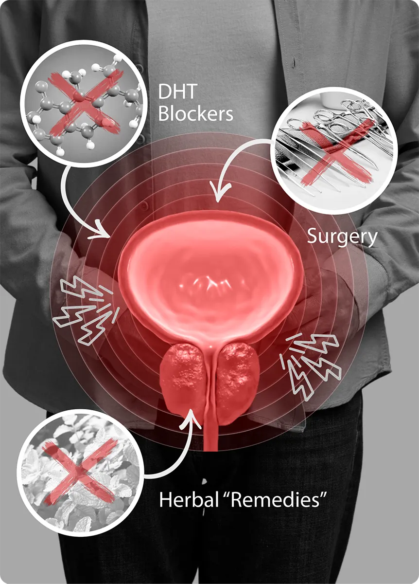 prostate relief